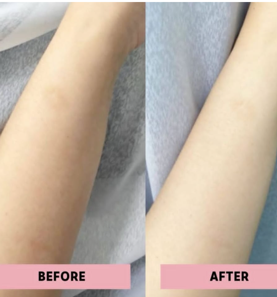Sun Kiss Body Buff